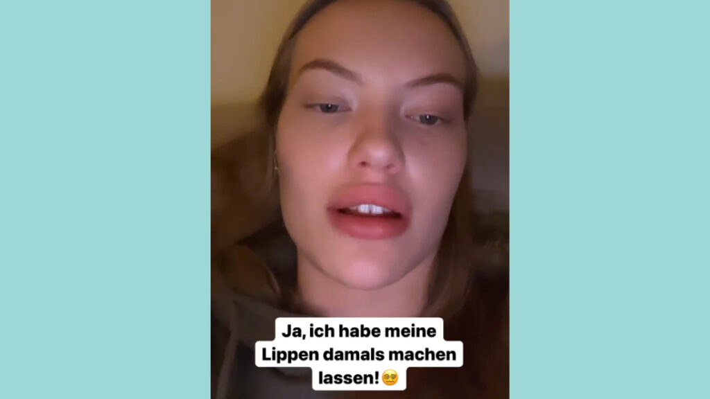 Cheyenne Ochsenknecht spricht über ihre Lippen-Unterspritzung.