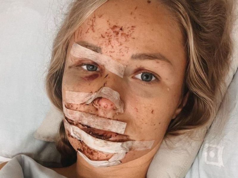 Jil Eileen: So geht es der Influencerin nach ihrem schrecklichen Unfall