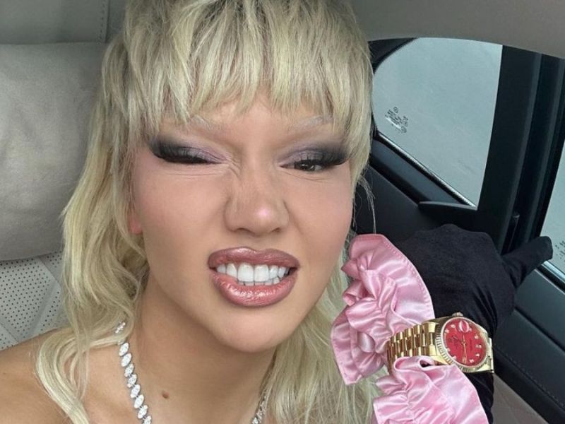 Shirin David provoziert mit Insta-Post: „Ich liebe Operationen“